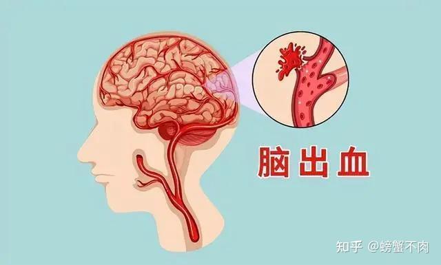 高血压的危害你注意了吗？